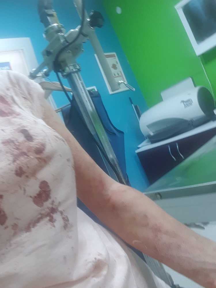 Başıboş Kangallar Genç Kadına Saldırdı! (4)