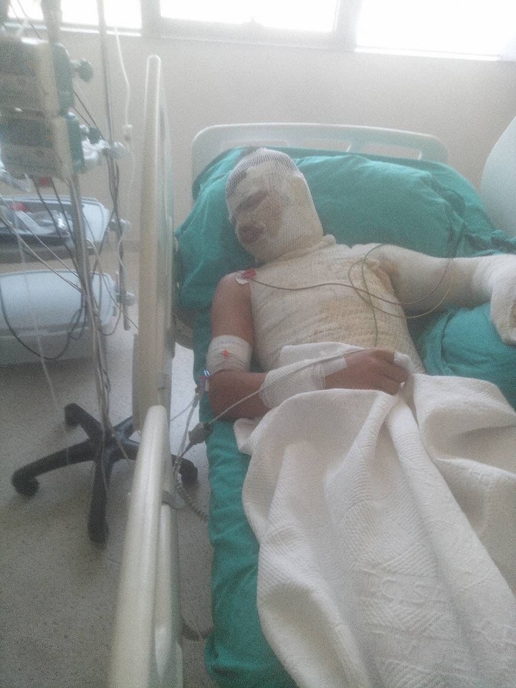 Güvenlik Kamerası Kaydetti Amca Deniz'i Yanıcı Maddeyle Yaktı (4)