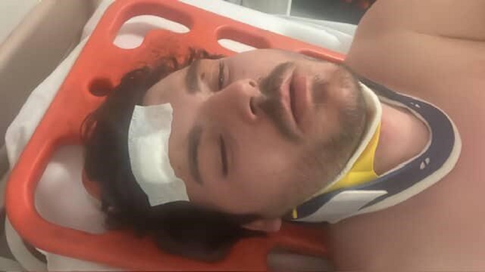 Kamyonla Sıkıştırıldı, Toyota’ya Saldırdılar Gebze’de Çirkin Kavga (1)