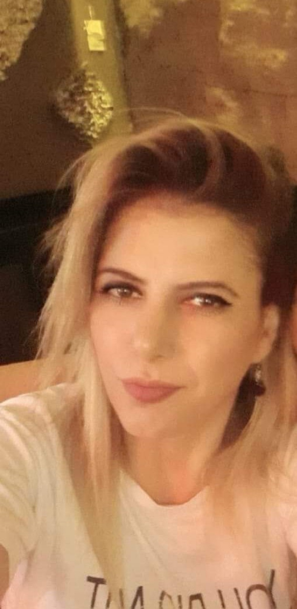 Yasemin’in Dramı Eski Sevgilisinin Kezzap Saldırısıyla Hayatı Karardı (3)