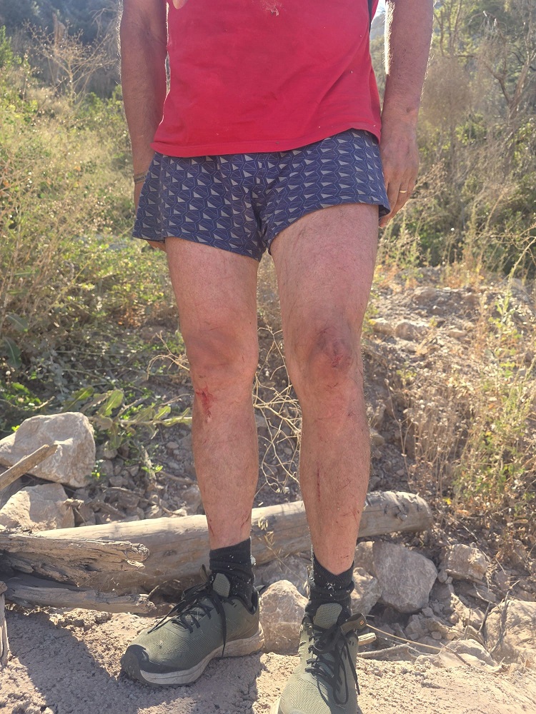 Marmaris'te Kaybolan Rus Turist Dronla Bulundu (4)