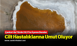 Çankırı’da Yüzde 24,5 Tuz İçeren Dereler Cilt Hastalıklarına Umut Oluyor