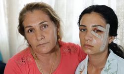 Eski Eşinin Şiddetine Maruz Kalan Kadın Gözaltı Sonrası Serbest Bırakılan Zanlıdan Şikayetçi