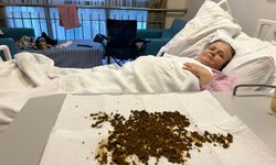 70 Yaşındaki Hastanın Safra Kesesinden 20 Bin Taş Çıkarıldı!