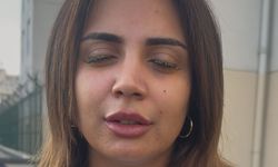 Kirpik Skandalı: Genç Kadın Gözünü Kaybetme Tehlikesi Yaşadı