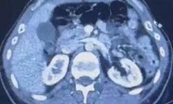 İran’dan Türkiye’ye yasaklı madde sevkiyatı