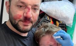 Saldırıda Yeni Kriz! Masum Vatandaş ‘Fail’ Diye Hedef Gösterildi