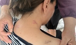 Ölü Taklidi Yaparak Kurtuldu