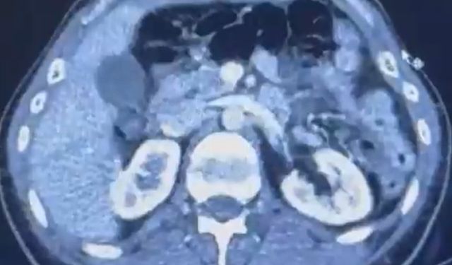 İran’dan Türkiye’ye yasaklı madde sevkiyatı