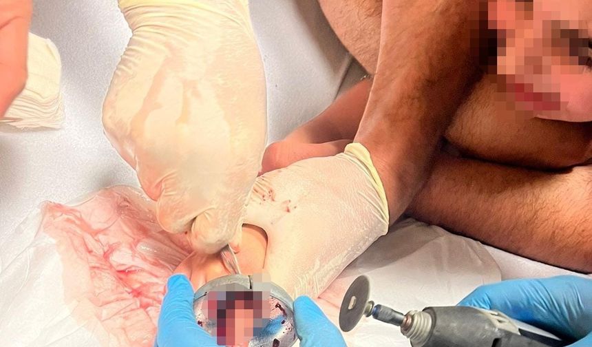 İnegöl’de Korku Dolu Anlar: Parmağı Demir Aksama Sıkıştı