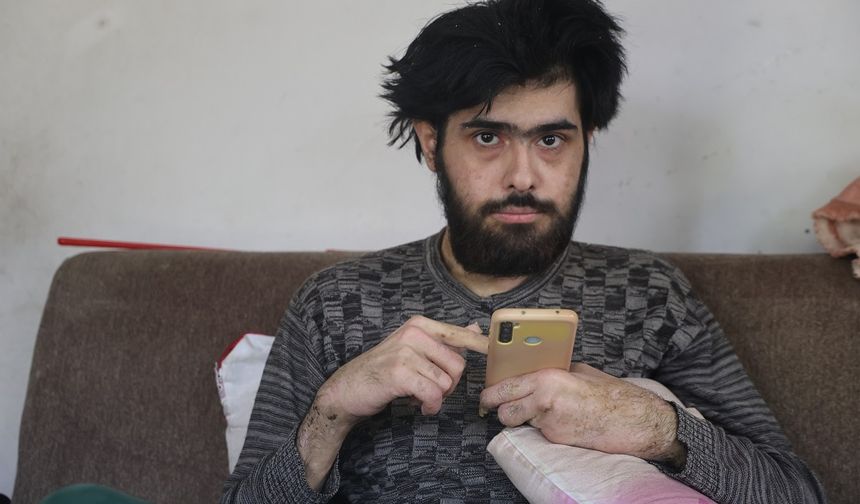 Hatay’da 3 Yıldır Evden Çıkmayan Gencin Dramı